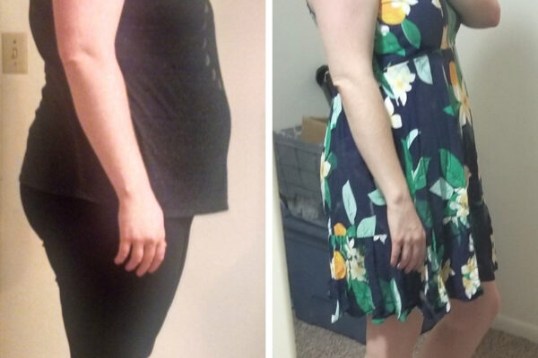 80 lb Keto Weightloss Before and After Photos