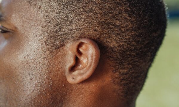 Preventing The Most Common Malfunctions In Your Hearing Aids