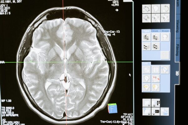 Who's Involved In Making a Medical Diagnosis?