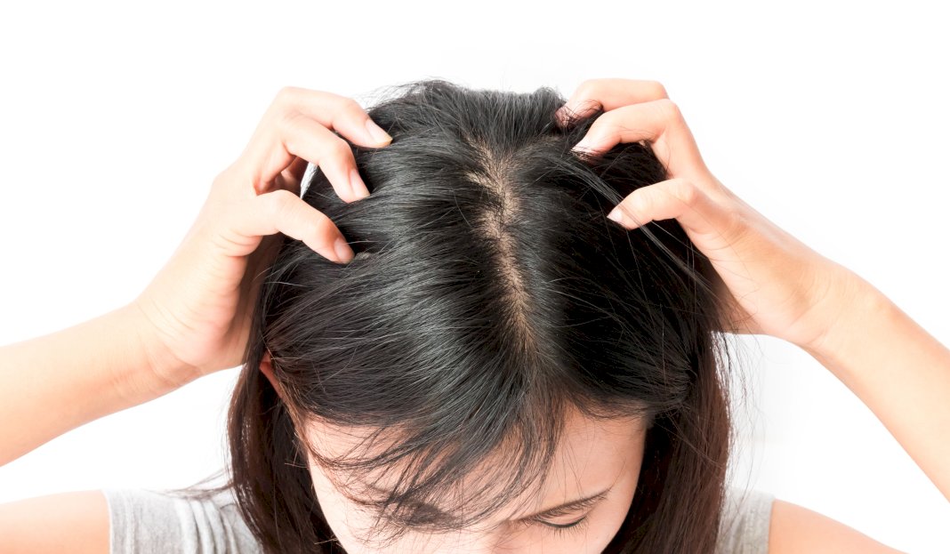 5 Tips to Get Rid of Your Itchy Scalp